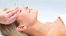 acupuncture omaha