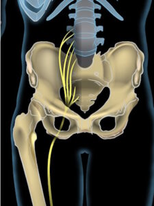 sciatic nerve illustration